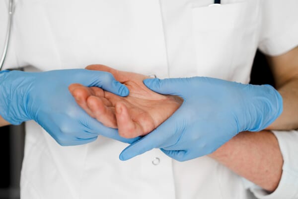 chirurgien examine la main d'un patient atteint de syndactylie