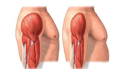 Comprendre la sarcopénie et la perte de masse musculaire avec l’âge