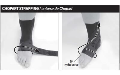 Strapping pour entorse de Chopart