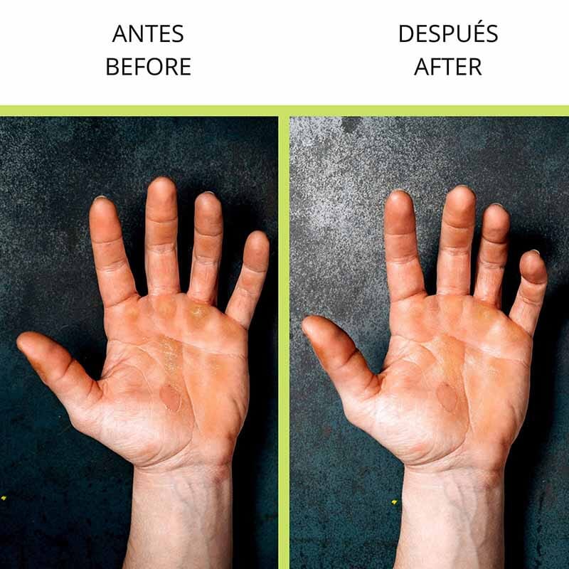 Velites Stone Callus Remover 4