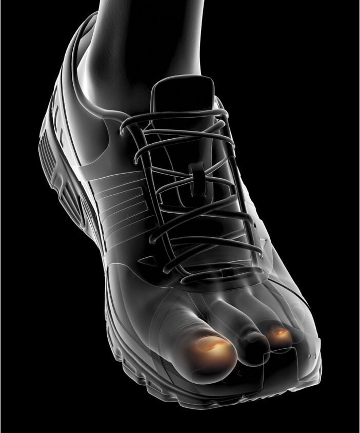 PROTECTION ONGLES BLEUS 2