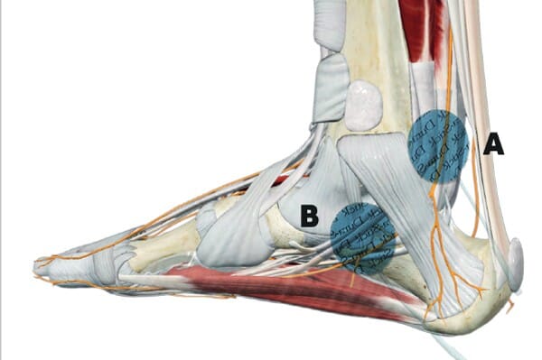 Cefar URO Chattanooga 4