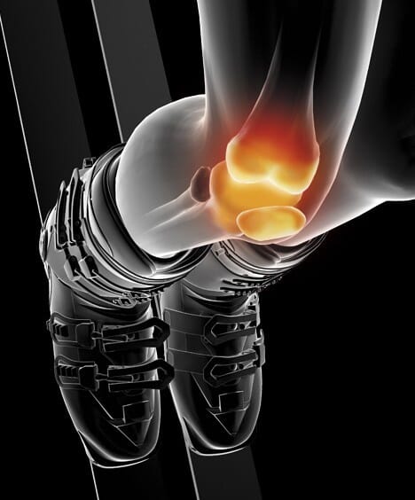 GENOUILLERE ROTULIENNE SKI FLEX 03 2