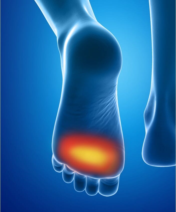 Coussinets Discrets Epitact 2