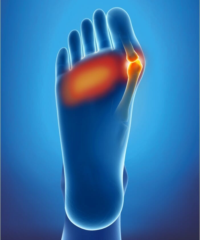 Coussinet Double Protection Epitact 2