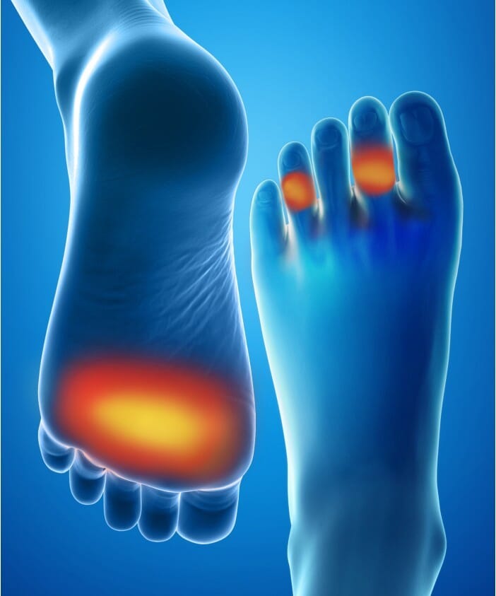 Protège-Pointes orteils plantaires et orteils en marteau Epitact 2