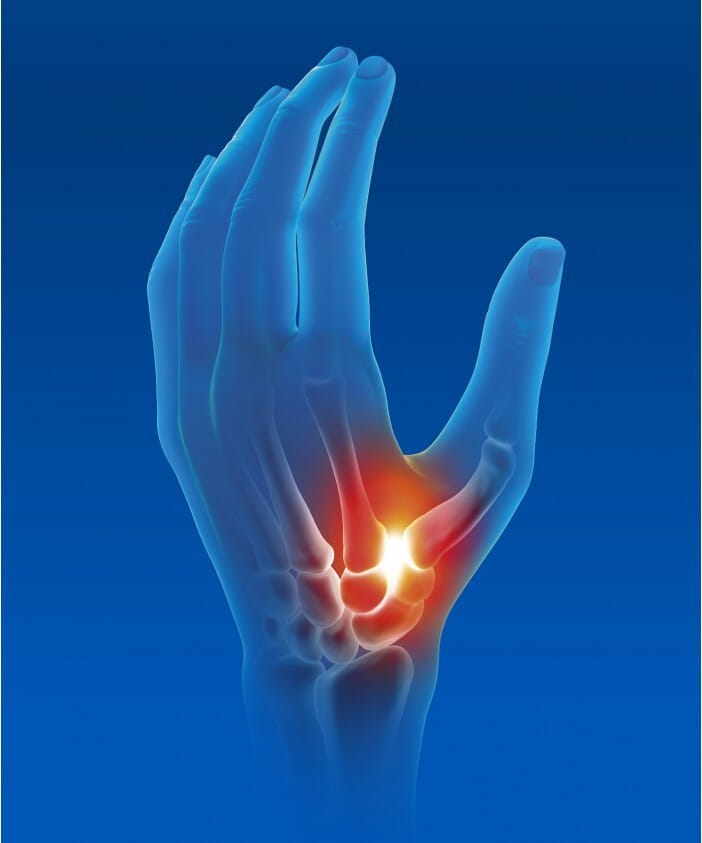 Orthèse Pouce Souple Epitact 2